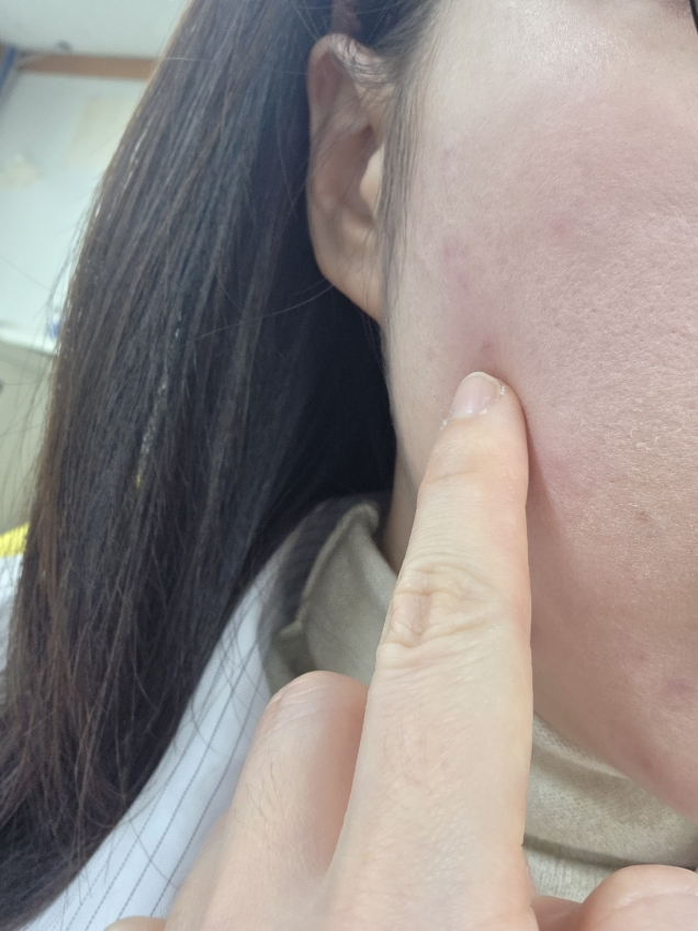 스킨앤랩 (SKIN&LAB) 쓰리디 피디알엔 엑스 콜라겐 랩핑 마스크 review image