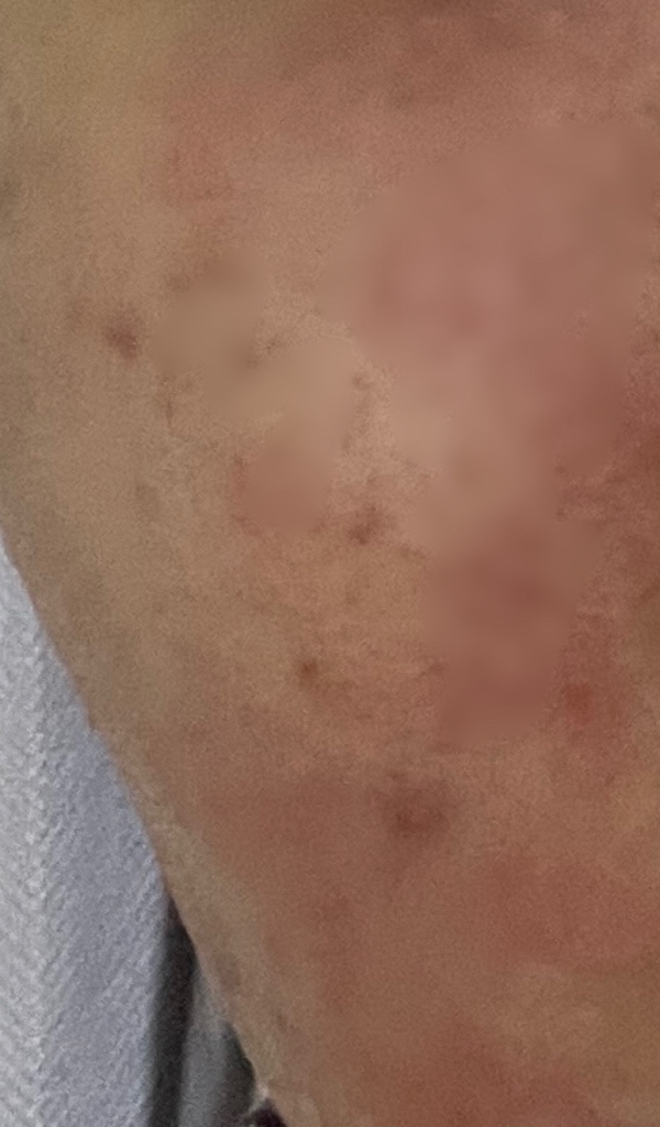 스킨푸드 (SKINFOOD) 푸드 마스크 [샤인머스캣시카바하] review image