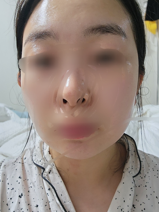 센텔리안24 (CENTELLIAN24) 마데카 크림 타이트 리프팅 review image