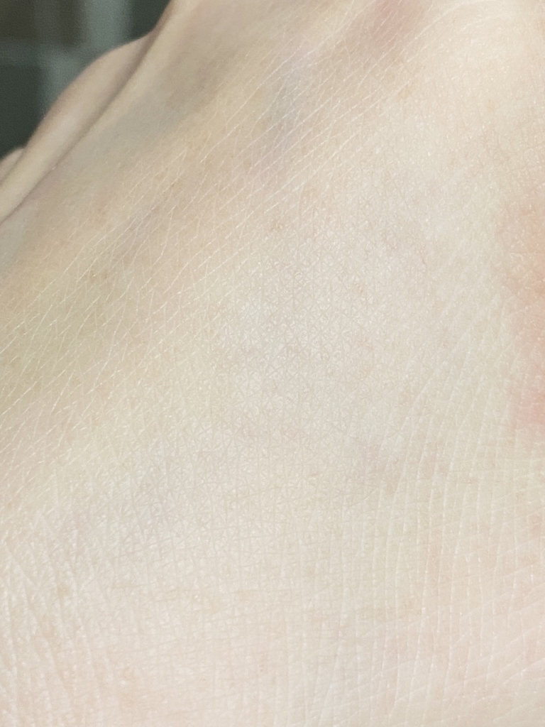 아이소이 (ISOI) 아크니 닥터 1st 블랙 딥 클렌징 폼 review image