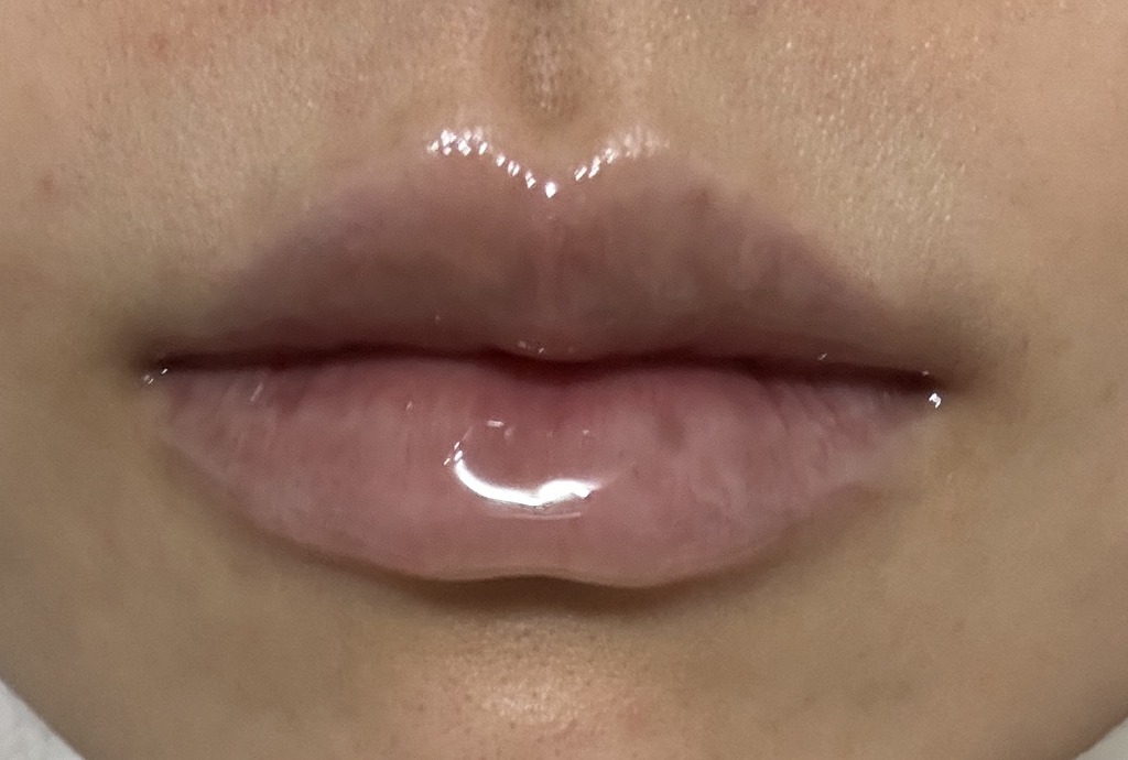 보나메두사 (bonamedusa) 립 웨이브 딜리트 review image