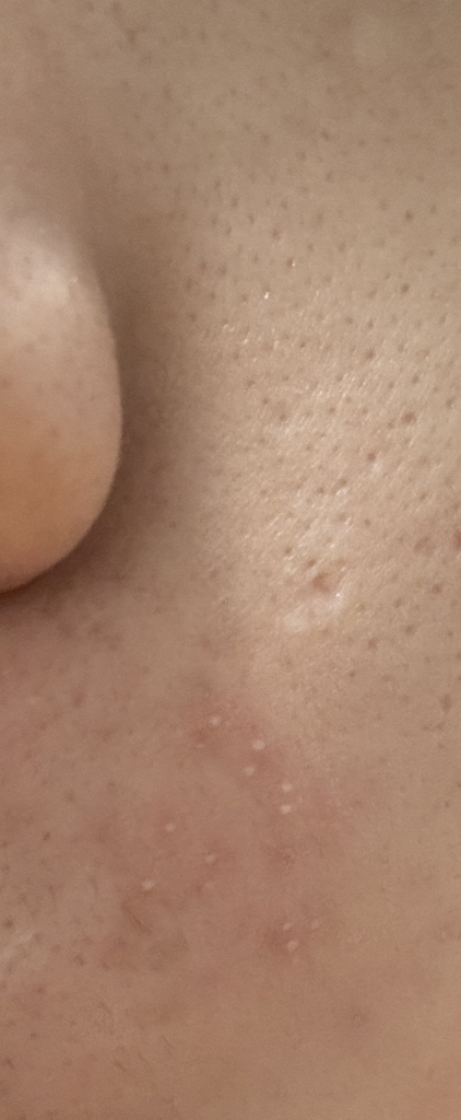 아비브 (Abib) 껌딱지 시트 마스크 [마데카소사이드스티커] review image