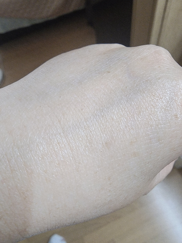 아이소이 (ISOI) 블레미쉬 케어 업 세럼 review image