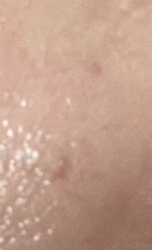 메디힐 (MEDIHEAL) 피디알엔 모공 탄력 패드 review image