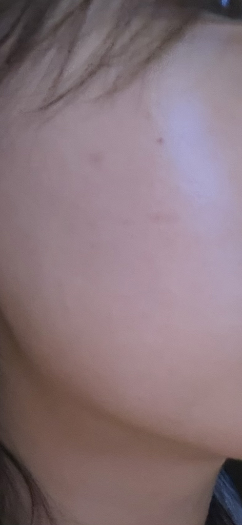 PDRN 粉红色肽原料安瓿的真实用户使用照片