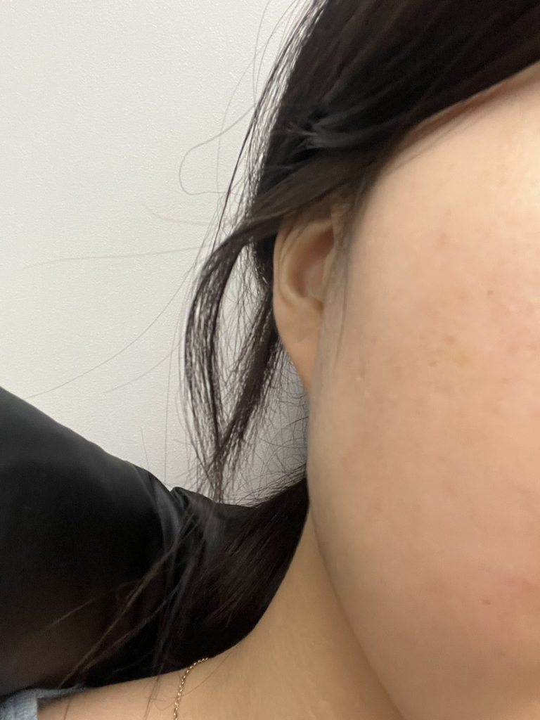 小美人鱼公主洁肤水的真实用户使用照片