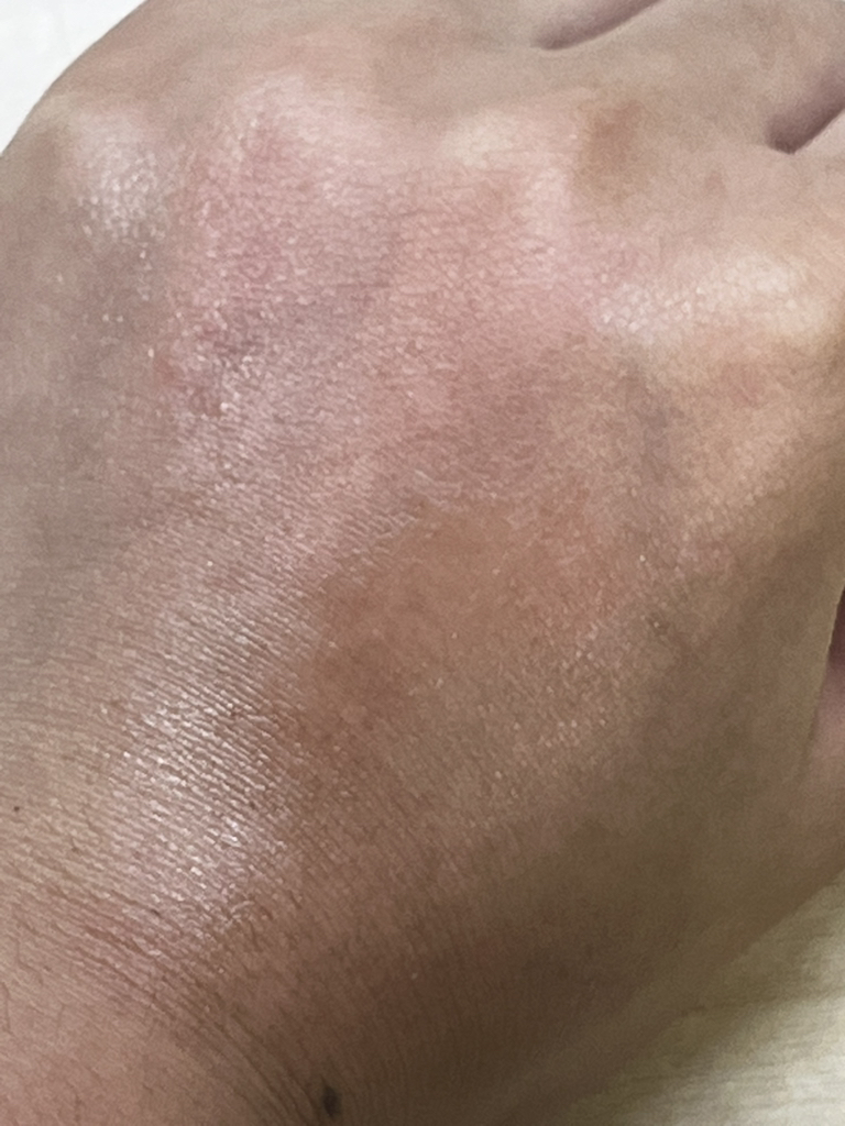 玫瑰液体面膜的真实用户使用照片