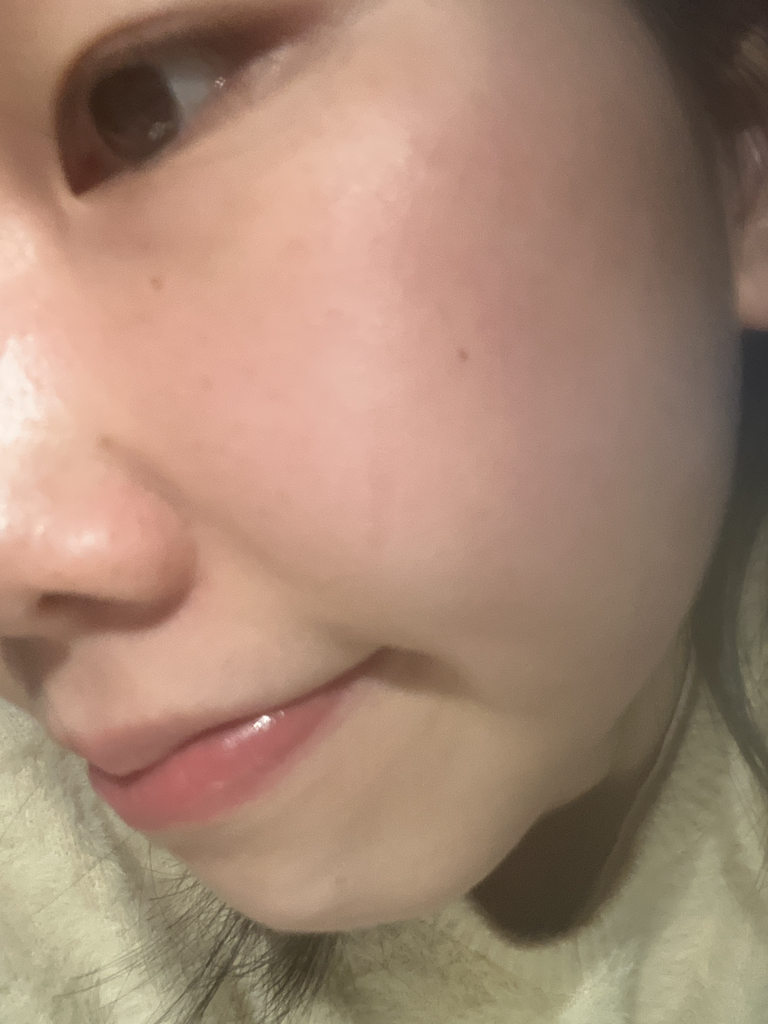 아렌시아 (ARENCIA) 레드 스무디 세럼 8 review image