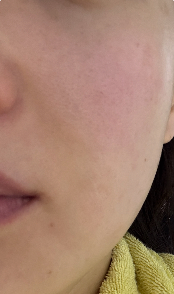 玫瑰液体面膜的真实用户使用照片