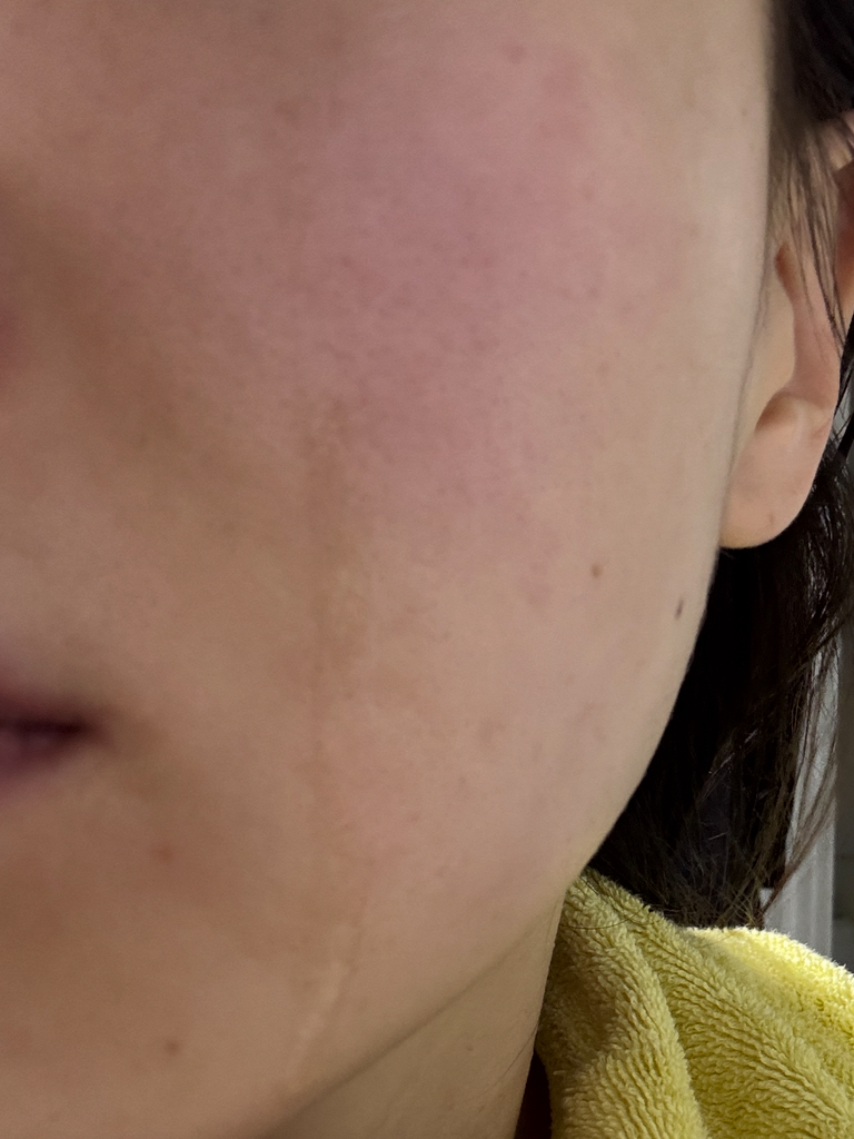 玫瑰液体面膜的真实用户使用照片