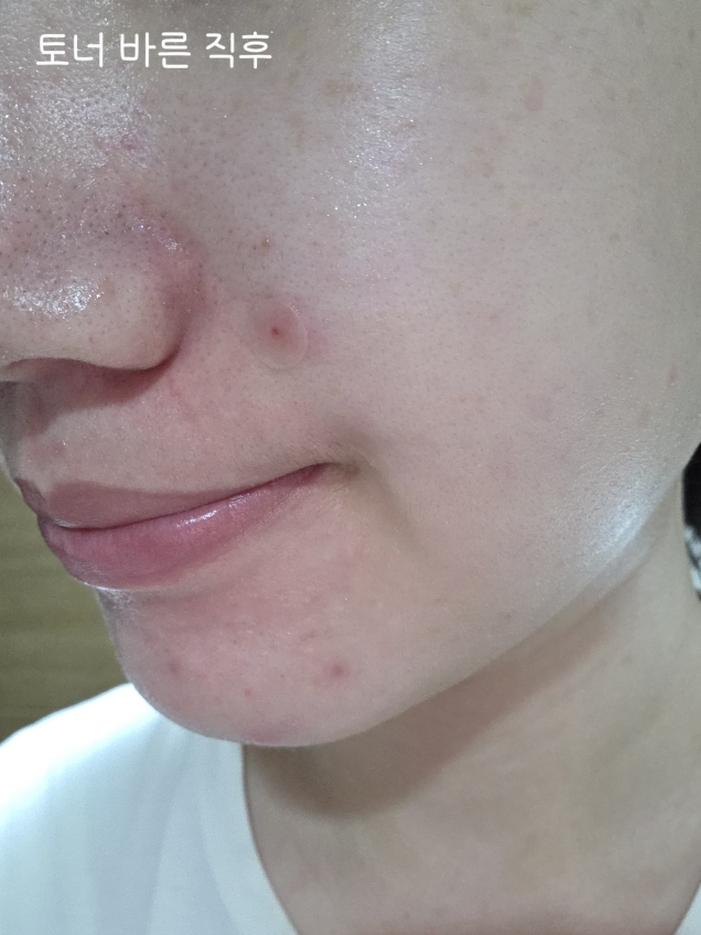 비그린 (Vegreen) 무알콜 뮤신 에센스 토너 review image