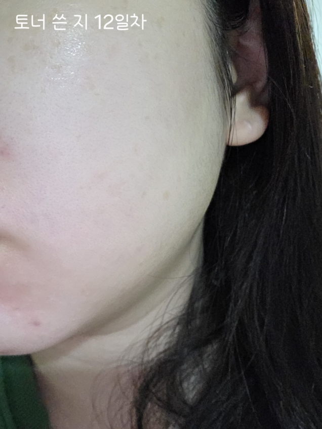 비그린 (Vegreen) 무알콜 뮤신 에센스 토너 review image