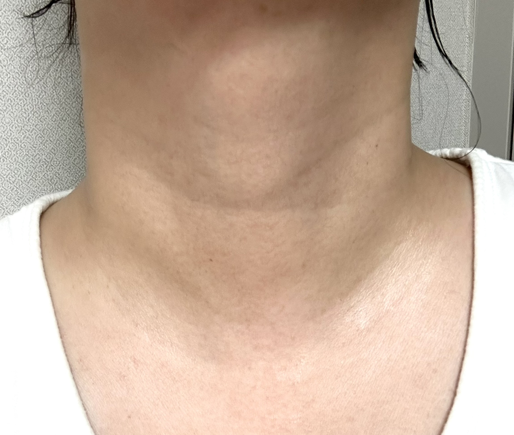 MARSHIQUE 颈部皱纹修复水凝胶贴片 common.review image