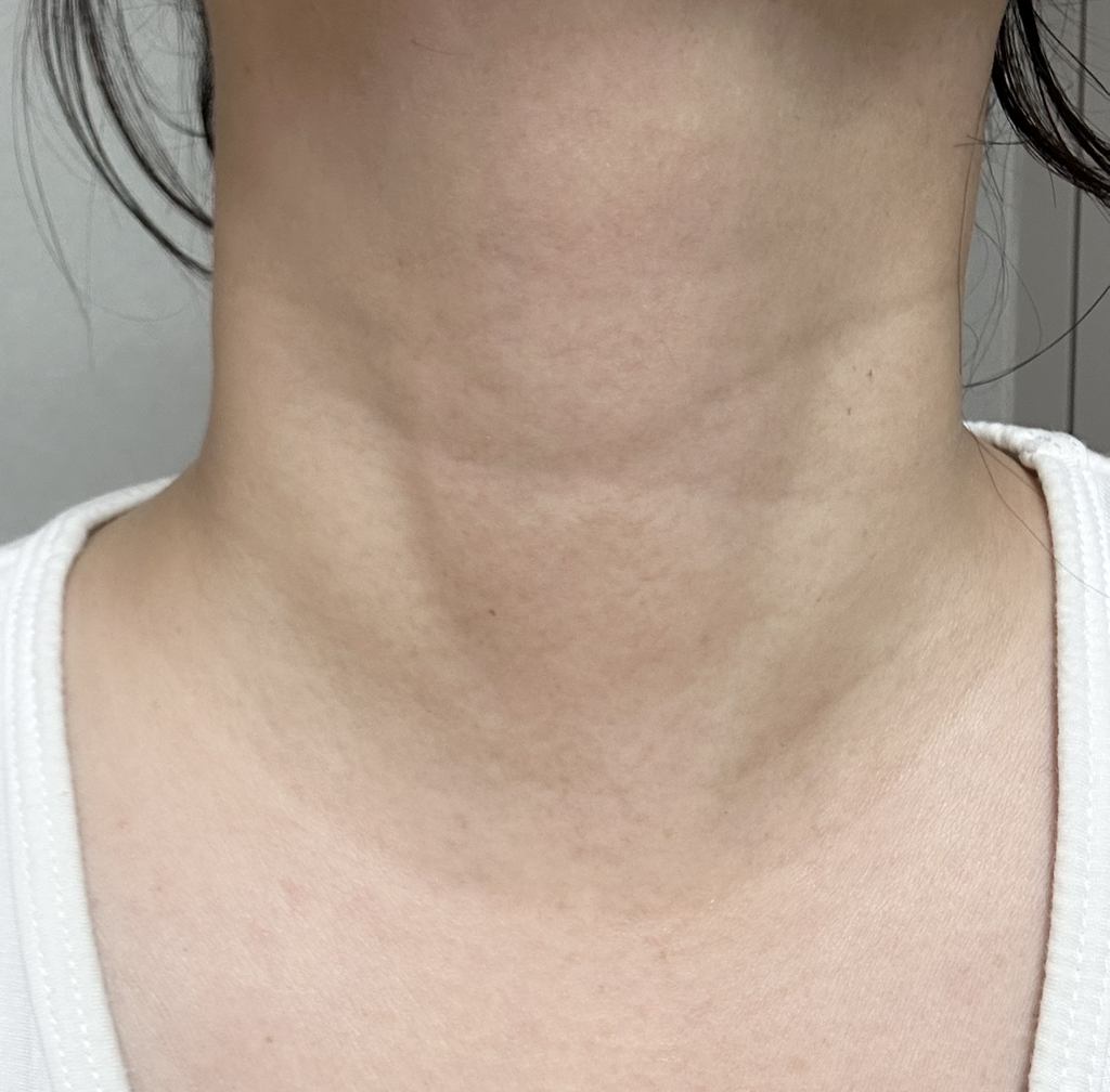 MARSHIQUE 颈部皱纹修复水凝胶贴片 common.review image