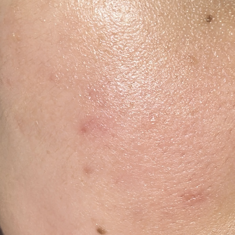 Ảnh đánh giá thực tế của người dùng về Orange Skin Delete Soft Green