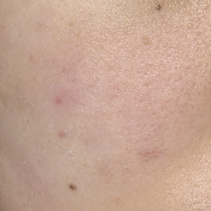 Ảnh đánh giá thực tế của người dùng về Orange Skin Delete Soft Green