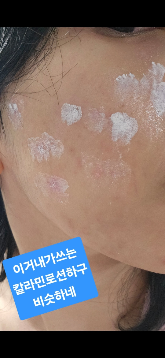 닥터자르트 (Dr.Jart+) 컨트롤에이™ 티트리먼트 수딩 스팟 review image
