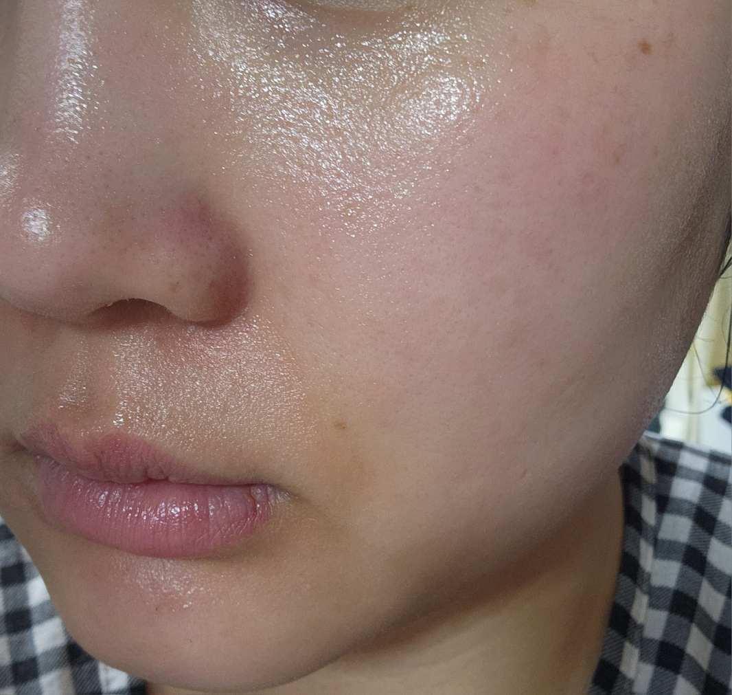 碧菲音 积雪草淄醇精华 common.review image