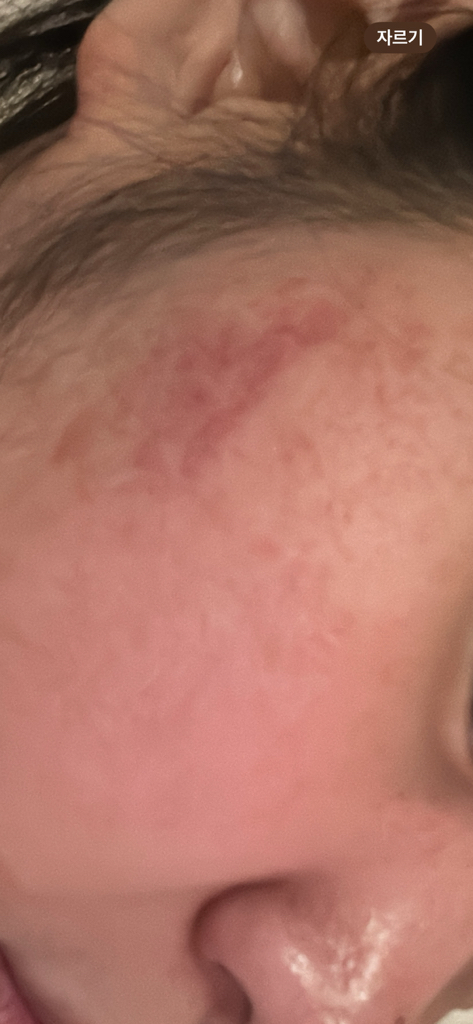 1025 独岛乳液的真实用户使用照片