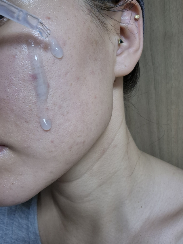 마몽드 (Mamonde) 카밍 샷 아줄렌 흔적 수분 앰플 review image