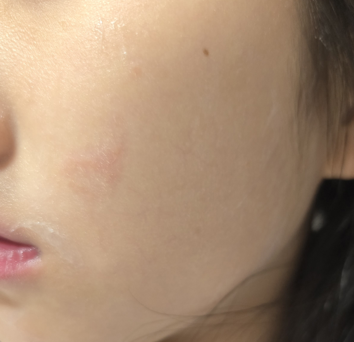 아토팜 (ATOPALM) 릴렉싱 나이트 밤 review image