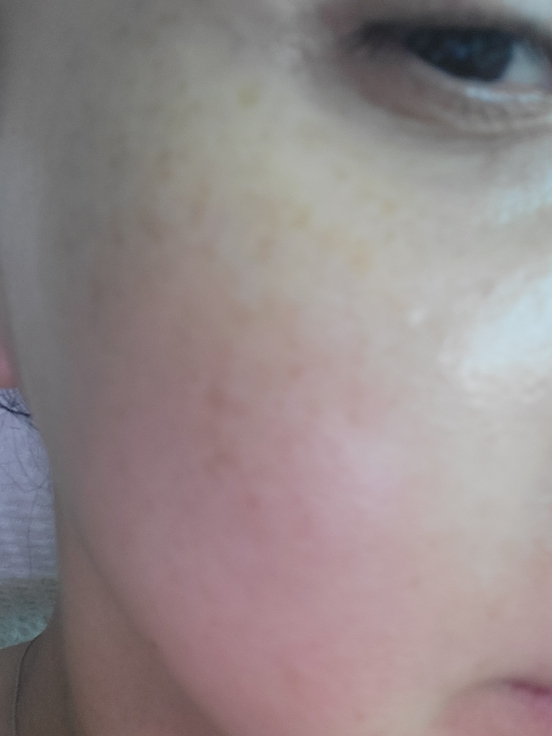 비플레인 (beplain) 시카테롤 토너 review image