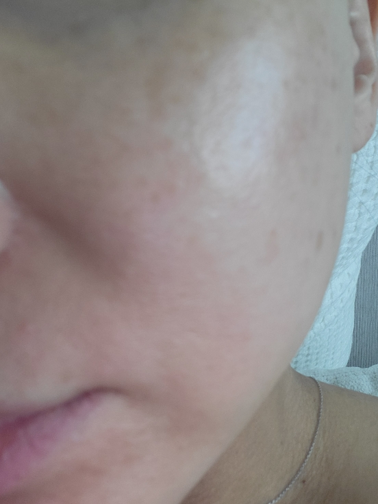 舒缓芦荟胶的真实用户使用照片