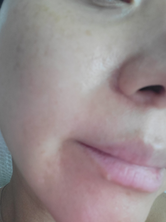 센텔리안24 (CENTELLIAN24) 마데카크림 파워 부스팅 포뮬러 review image