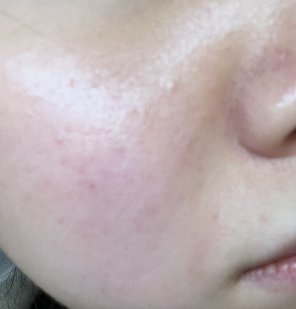 唯拉珠 真正的透明质酸 100 面霜 common.review image