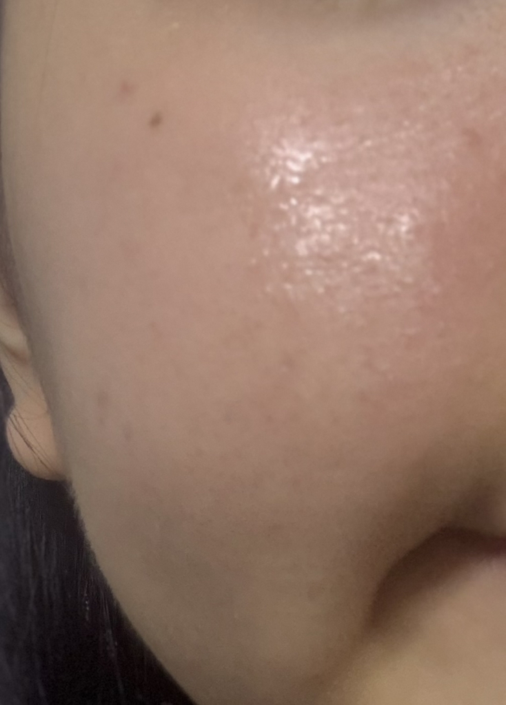 코르테 (CORTHE) 더모 레쥬비네이션 리젤 review image