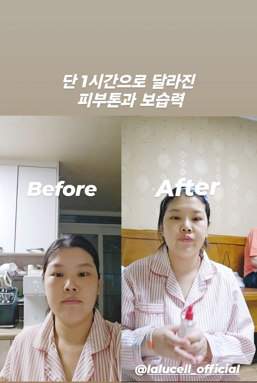 라루셀 (LALUCELL) 미스틱 라이트 시카 리프레싱 하이드로겔 마스크 review image