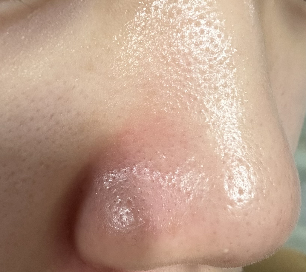 일소 (ilso) 슈퍼 멜팅 세범 소프트너 review image