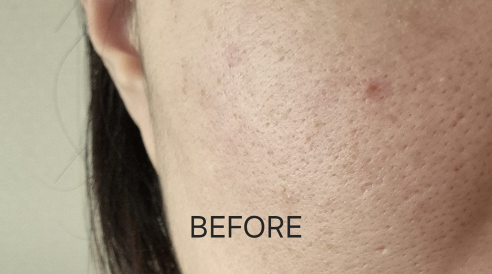 播种 超凡面部低分子量透明质酸精华液 review image