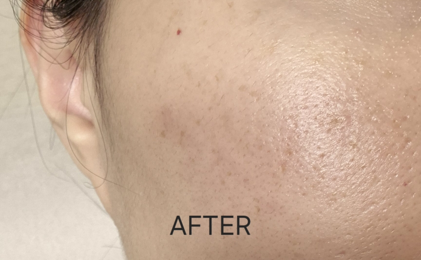 播种 超凡面部低分子量透明质酸精华液 review image