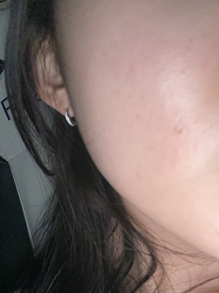 메디힐 (MEDIHEAL) 티트리 트러블 패드 review image