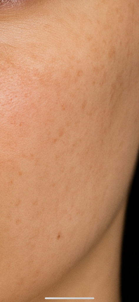 아누아 (Anua) 나이아신아마이드 10 TXA 4 다크 스팟 코렉팅 세럼 review image