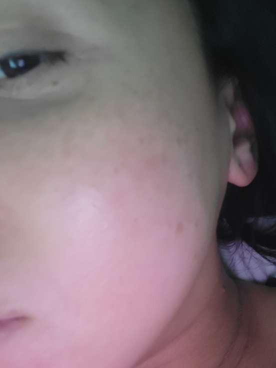 SCINIC Kem axit hyaluronic review image