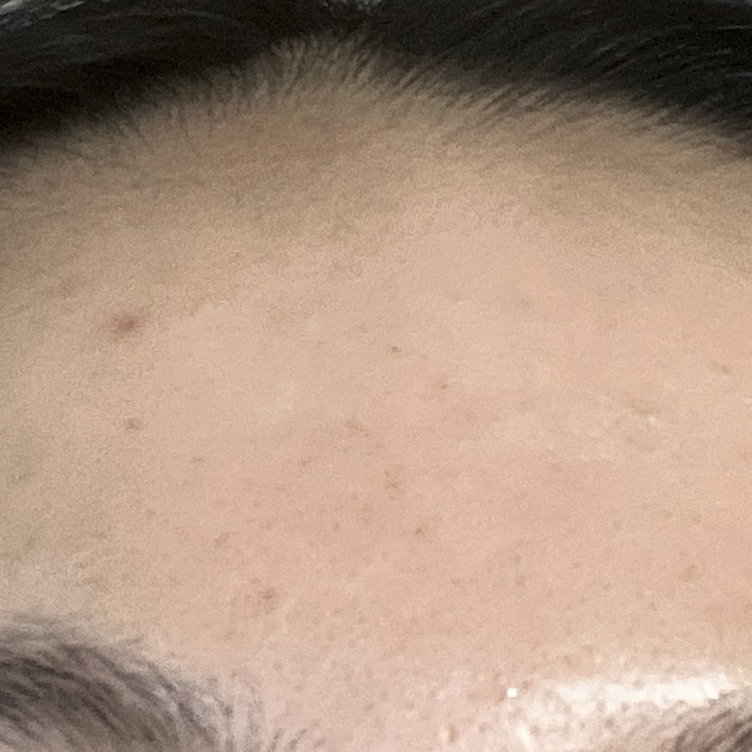 바이오코어 (BYOCORE) 피부면역 유산균 100억 review image