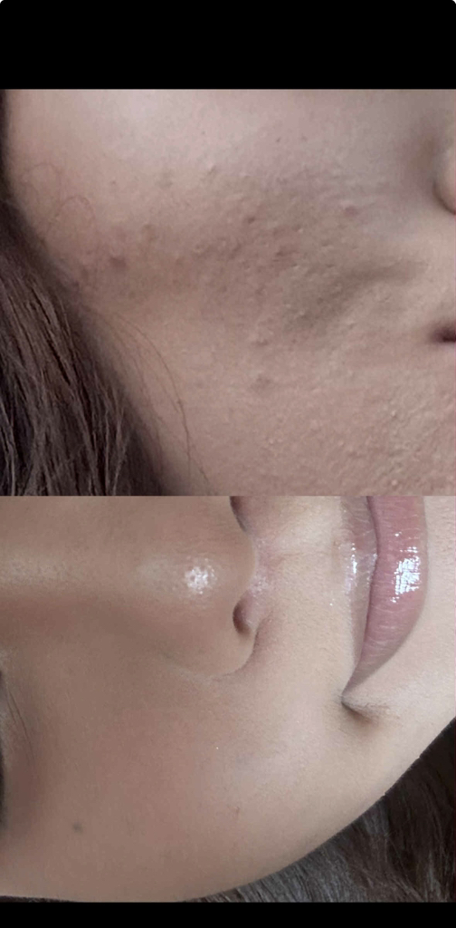 潤碧之茵 1 泛酸活性舒缓精华液 common.review image