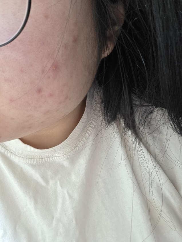 메디힐 (MEDIHEAL) 티트리 트러블 패드 review image