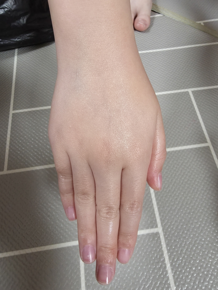 아토팜 (ATOPALM) 베이비 너리싱 오일 review image