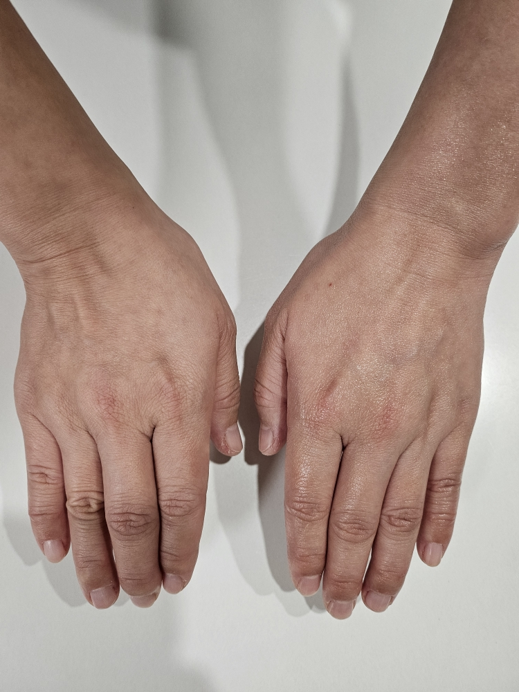 아토팜 (ATOPALM) 베이비 너리싱 오일 review image