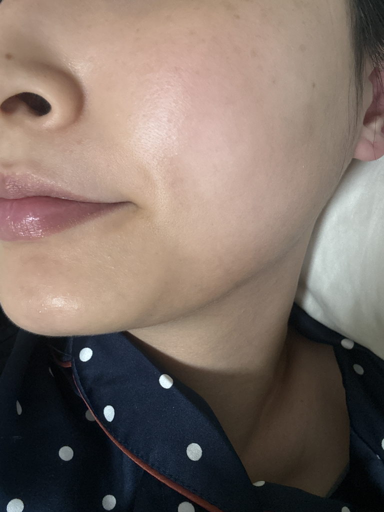 토리든 (Torriden) 다이브인 저분자 히알루론산 세럼 review image