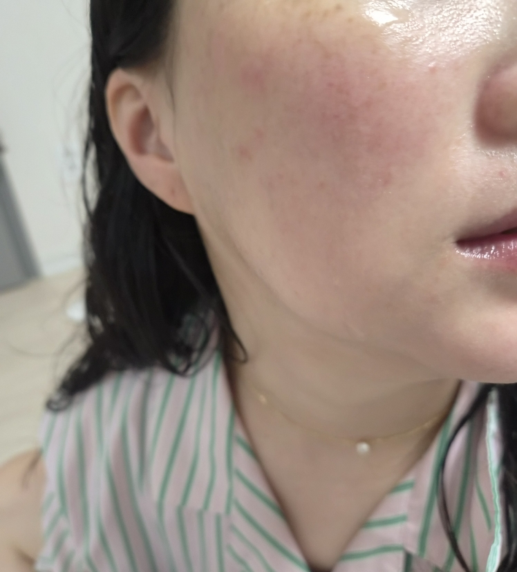 웰라쥬 (WELLAGE) 리얼 히알루로닉 블루 100 앰플 review image