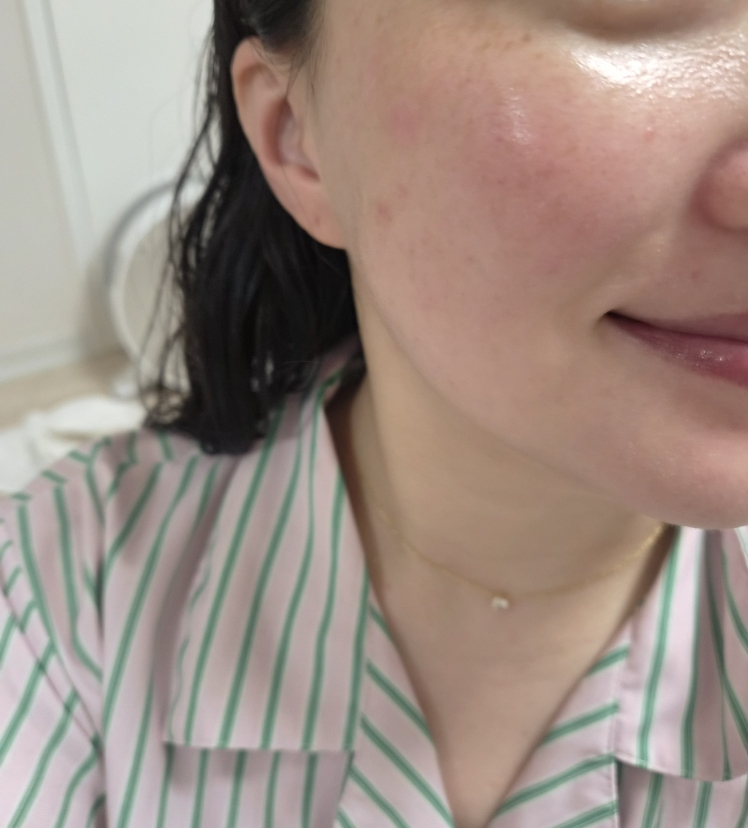 웰라쥬 (WELLAGE) 리얼 히알루로닉 블루 100 앰플 review image