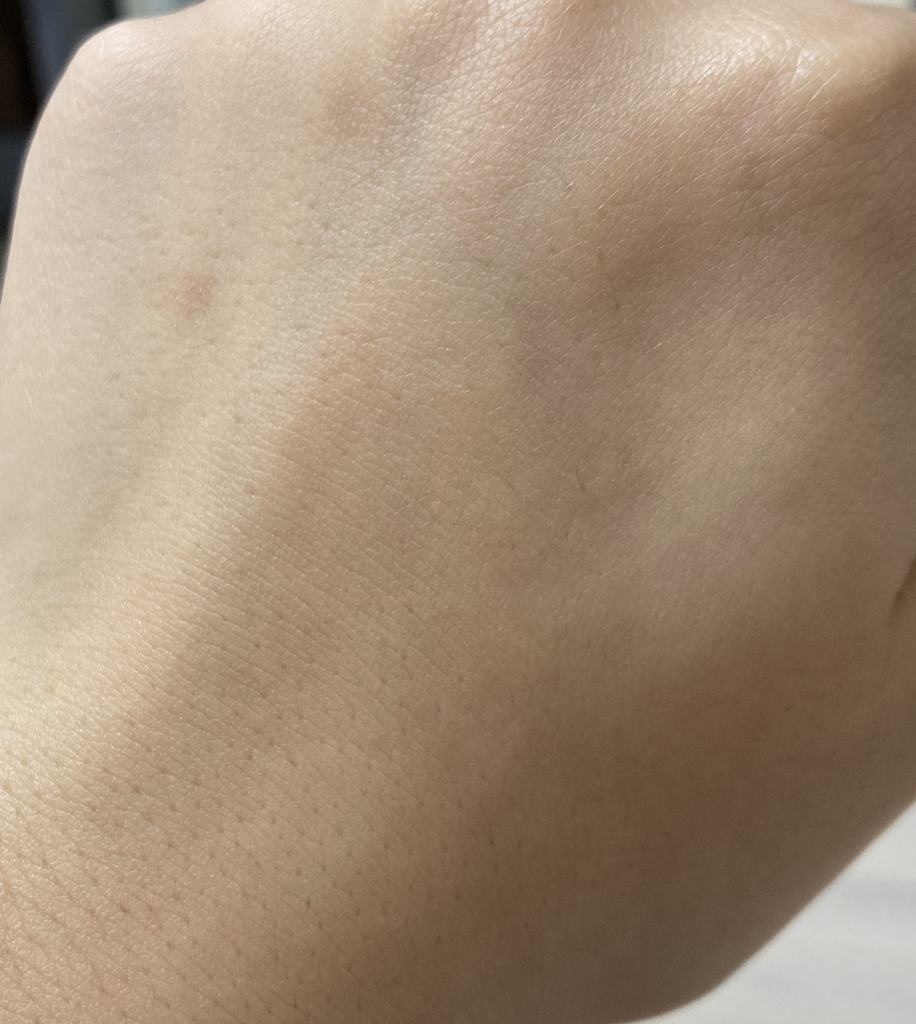 웰라쥬 (WELLAGE) 리얼 히알루로닉 블루 100 앰플 review image