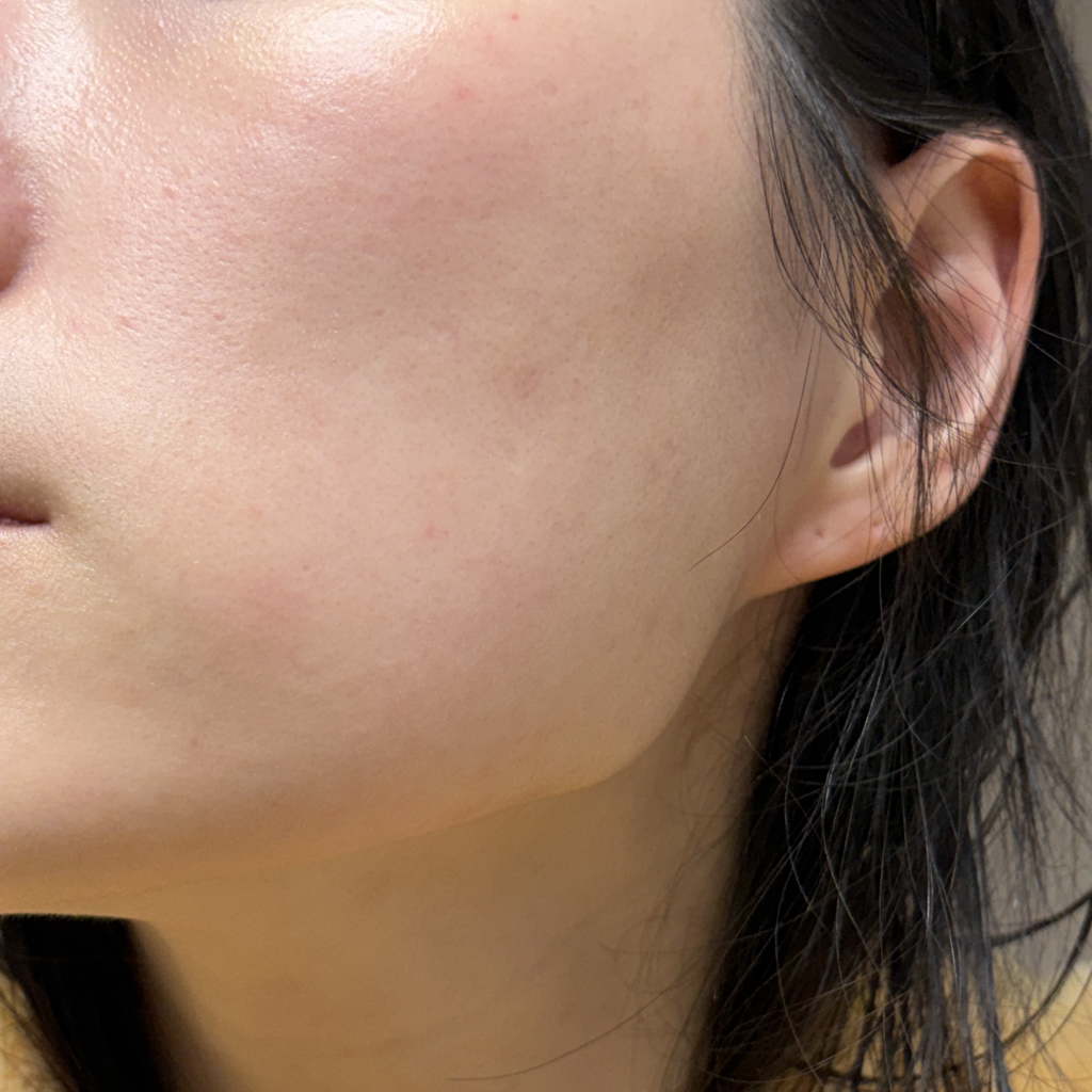 메디힐 (MEDIHEAL) 피디알엔 모공 탄력 세럼 review image