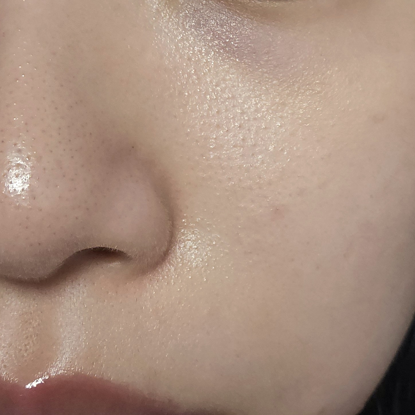 메디힐 (MEDIHEAL) 피디알엔 모공 탄력 세럼 review image