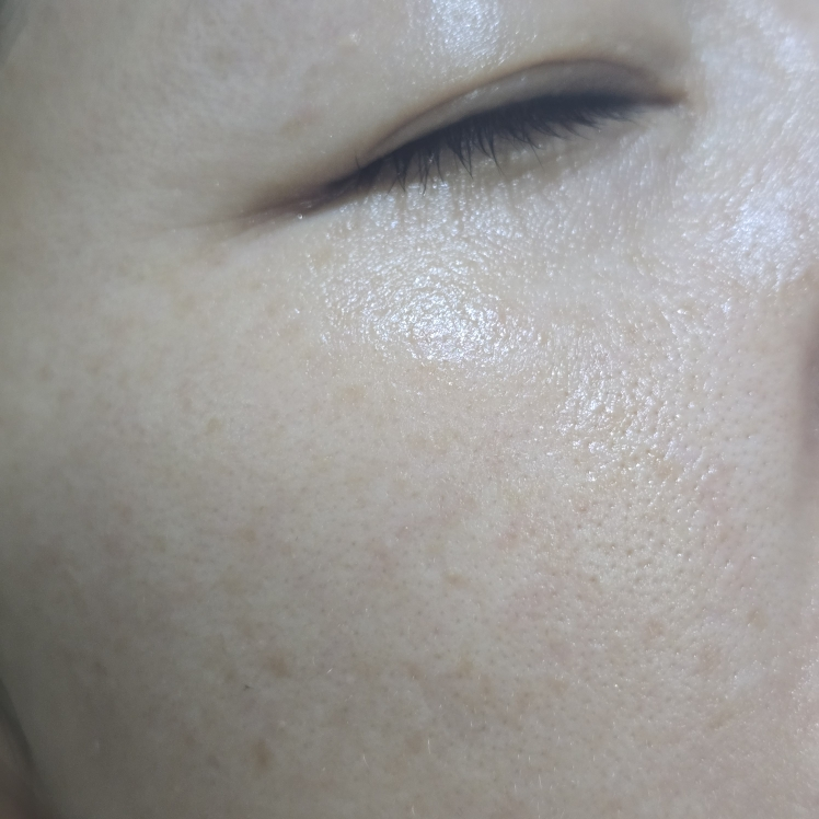 低分子玻尿酸保湿面霜的真实用户使用照片