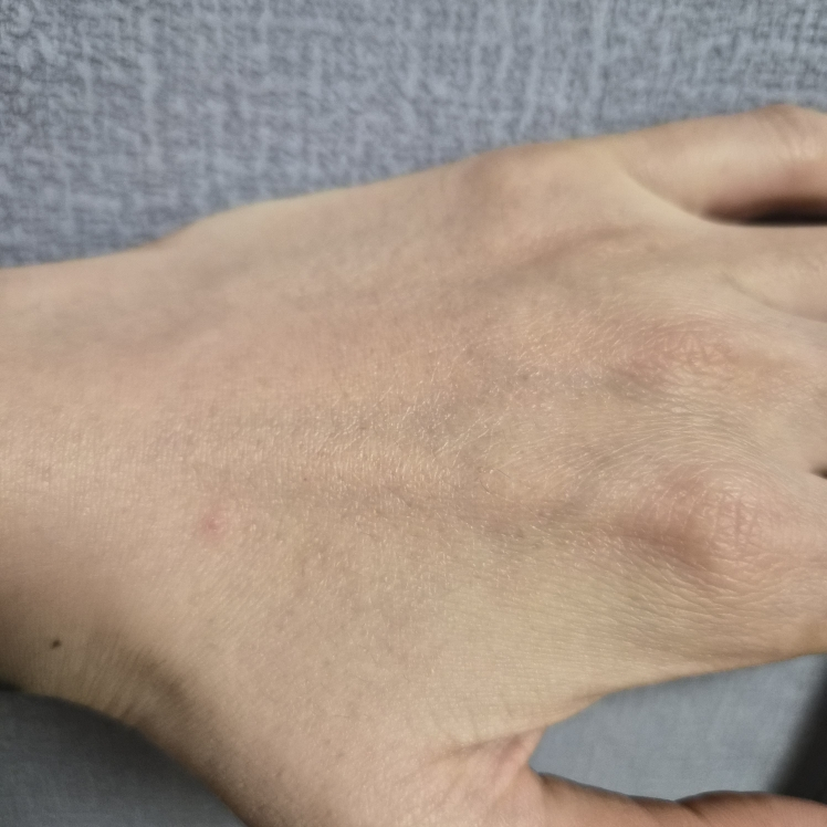 브링그린 (BRINGGREEN) 징크테카 트러블 세럼 review image